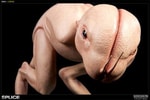 Dren View 2