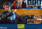 Anakin Skywalker Exclusive Edition (Prototype Shown) View 3