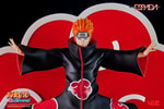 Pain (Tendo)- Prototype Shown