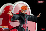 Pain (Tendo)- Prototype Shown