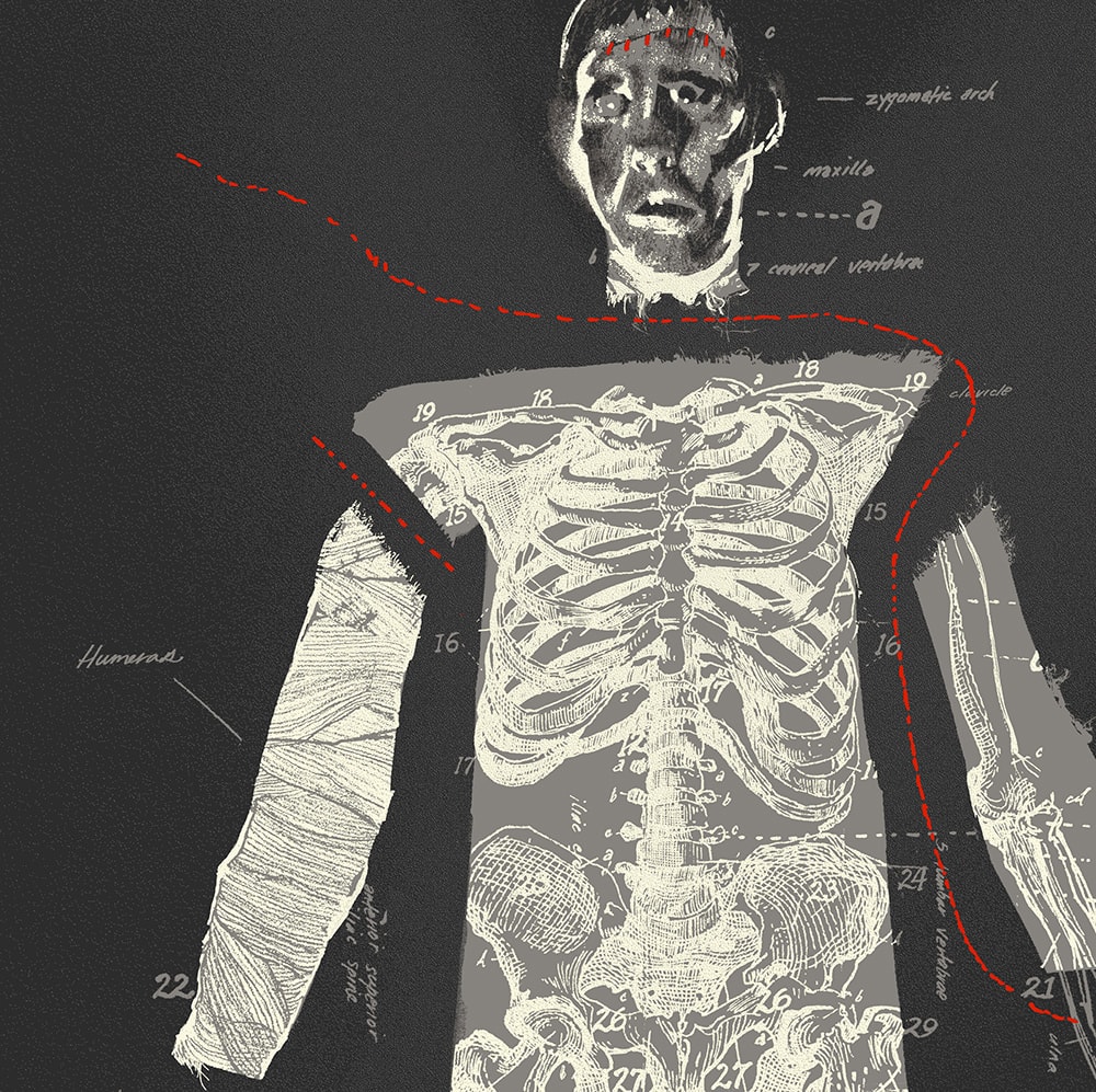 Hammer The Curse of Frankenstein Screenprint Movie Poster  View 3