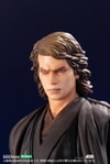 Anakin Skywalker (Prototype Shown) View 10
